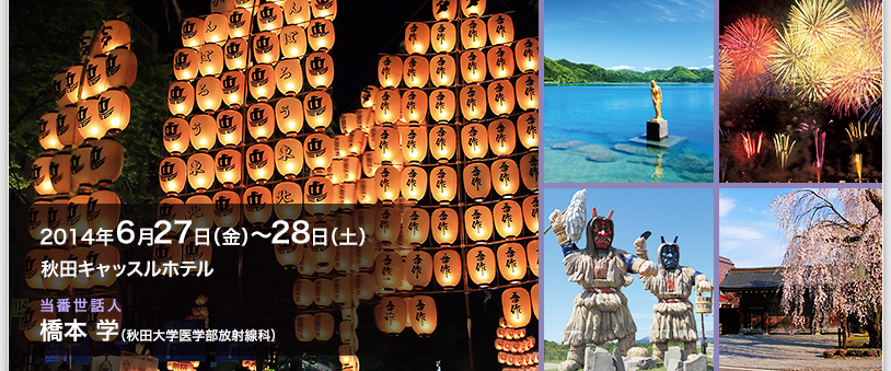 2014年6月27日（金）〜28日（土）　秋田キャッスルホテル　当番世話人：橋本 学（秋田大学医学部放射線科）